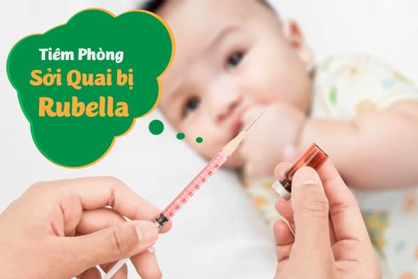 Tiêm Phòng Sởi Quai bị Rubella - Không Đáng Lo Nếu Chủng Ngừa Đầy Đủ