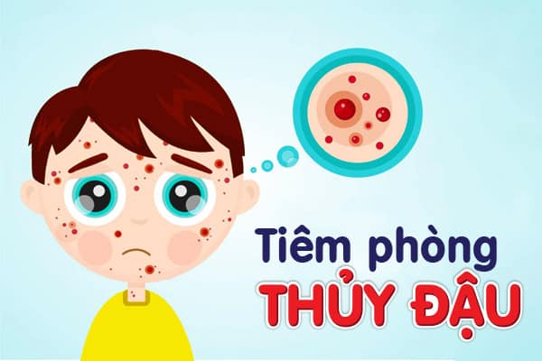 Thời Điểm Tiêm Phòng Thủy Đậu Đạt Hiệu Quả Bảo Vệ Tối Ưu